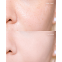 Гель-пилинг для лица с кислотой PHA - Axis-Y PHA Resurfacing Glow Peel - Фото 3
