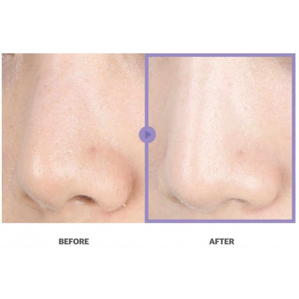 Отшелушивающие тонер-пэды для лица с мадекассосидом и BHA-кислотой - Celimax Heartleaf BHA Peeling Pad фото 4