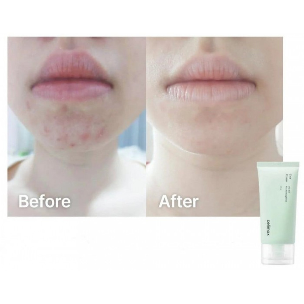 Успокаивающий крем для лица с центеллой азиатской - Celimax The Real Cica Soothing Cream фото 2
