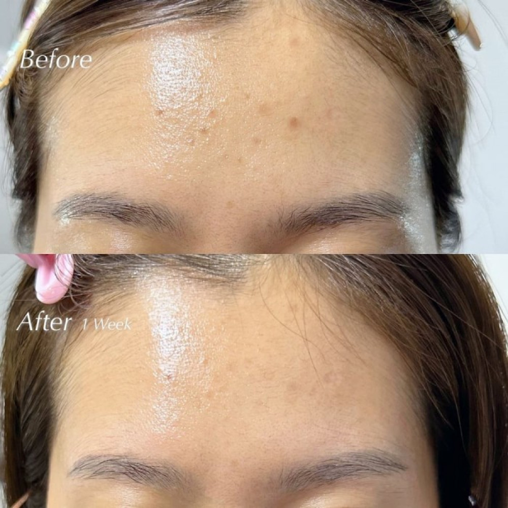 Зміцнююча сироватка для обличчя із вітаміном С - Dr. Althea Vitamin C Boosting Serum фото 2