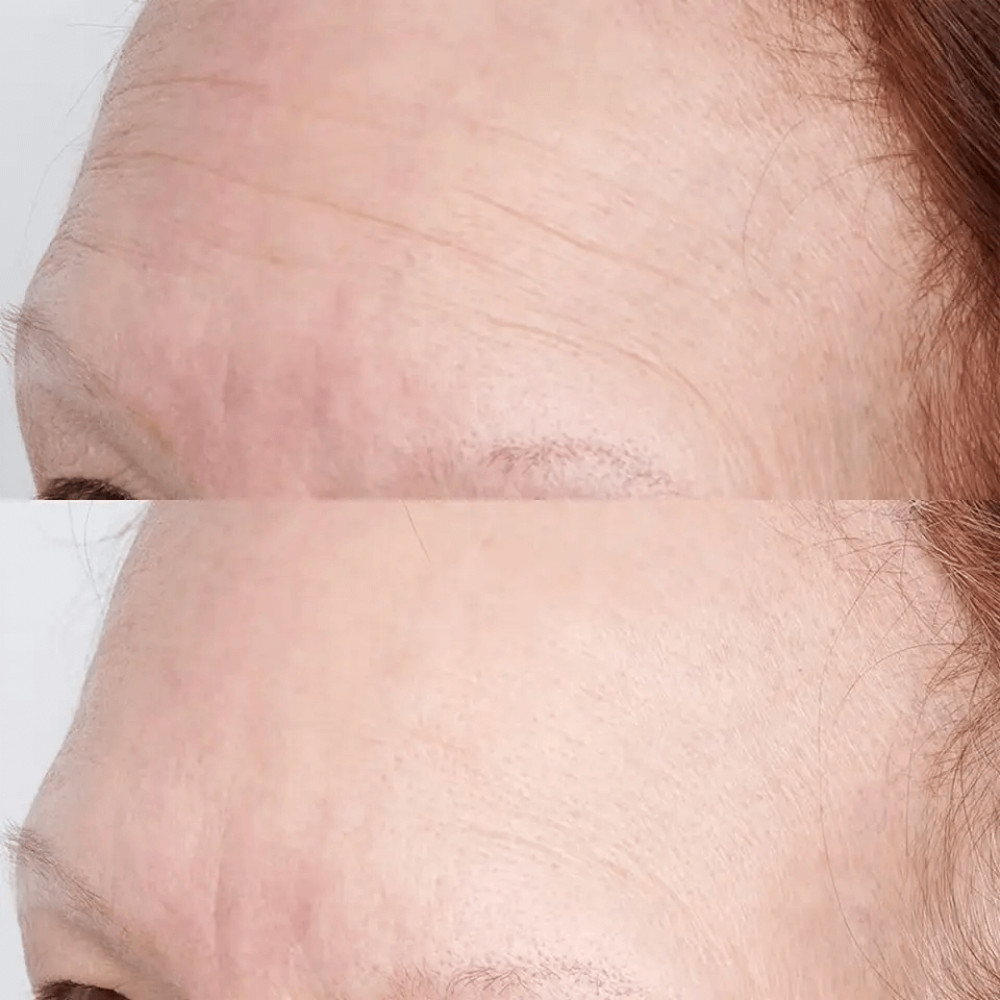 Інтенсивна зволожуюча маска - Perricone MD High Potency Hyaluronic Intensive Hydrating Mask фото 4