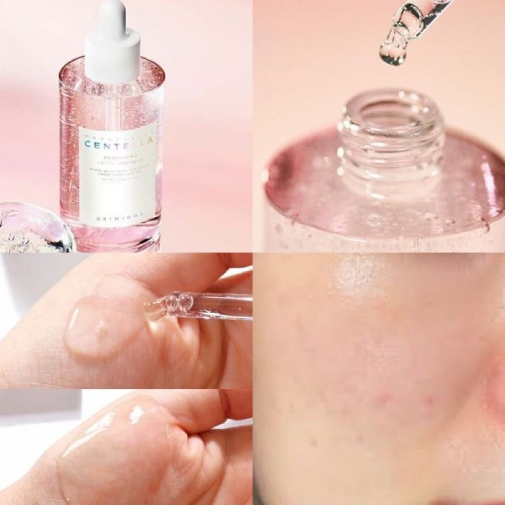 Сироватка для звуження пор та контролю жирності - Skin 1004 Madagascar Centella Poremizing Fresh Ampoule фото 2